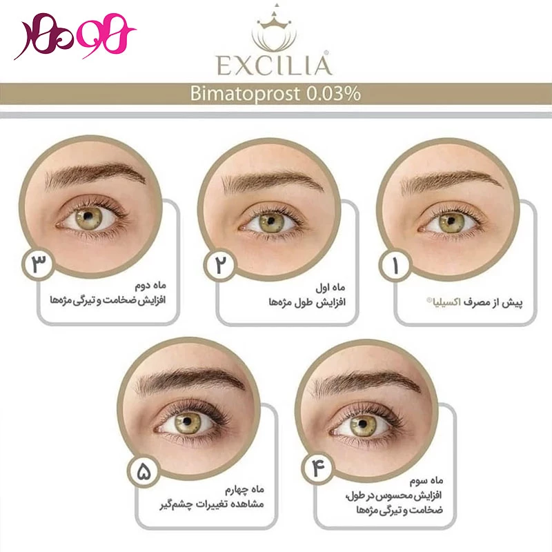 excilia